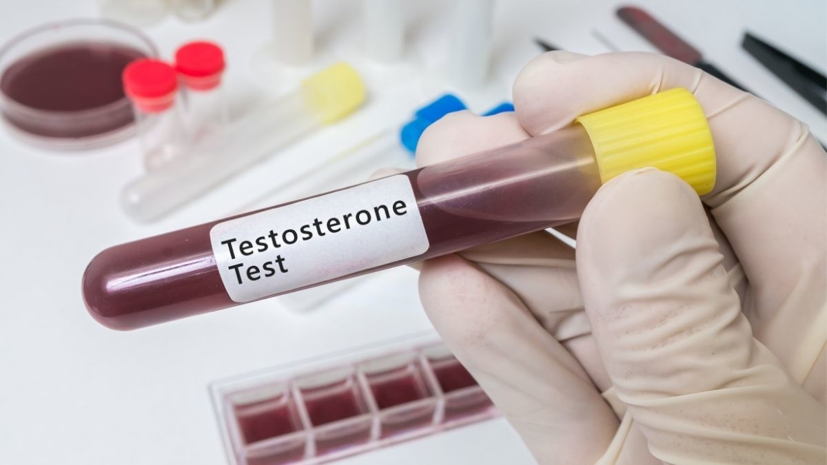testosteron